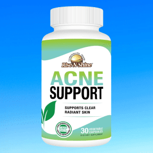 Acne Support by Rise-N-Shine Online for breakout reduction and clear skin