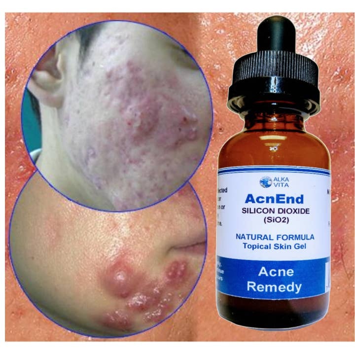 Cyskin gel cystic acne solution with fast-acting silicon dioxide